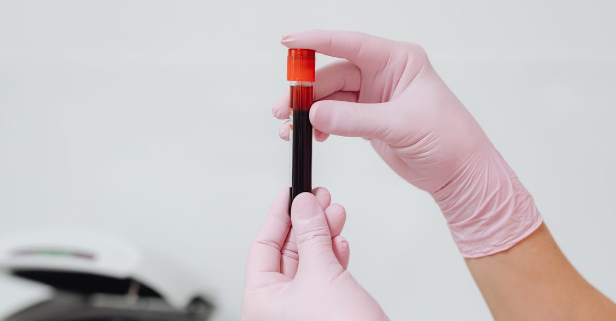 This Blood Test Beats Standard Cholesterol for Heart Risk