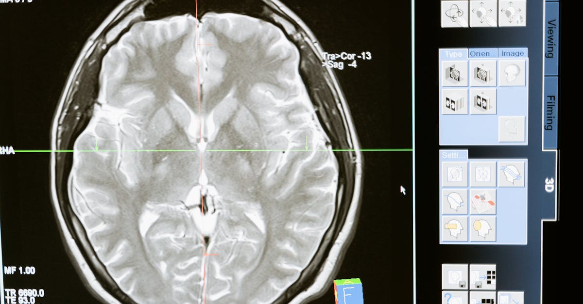 Your Childhood Surgery Might Be Aging Your Brain