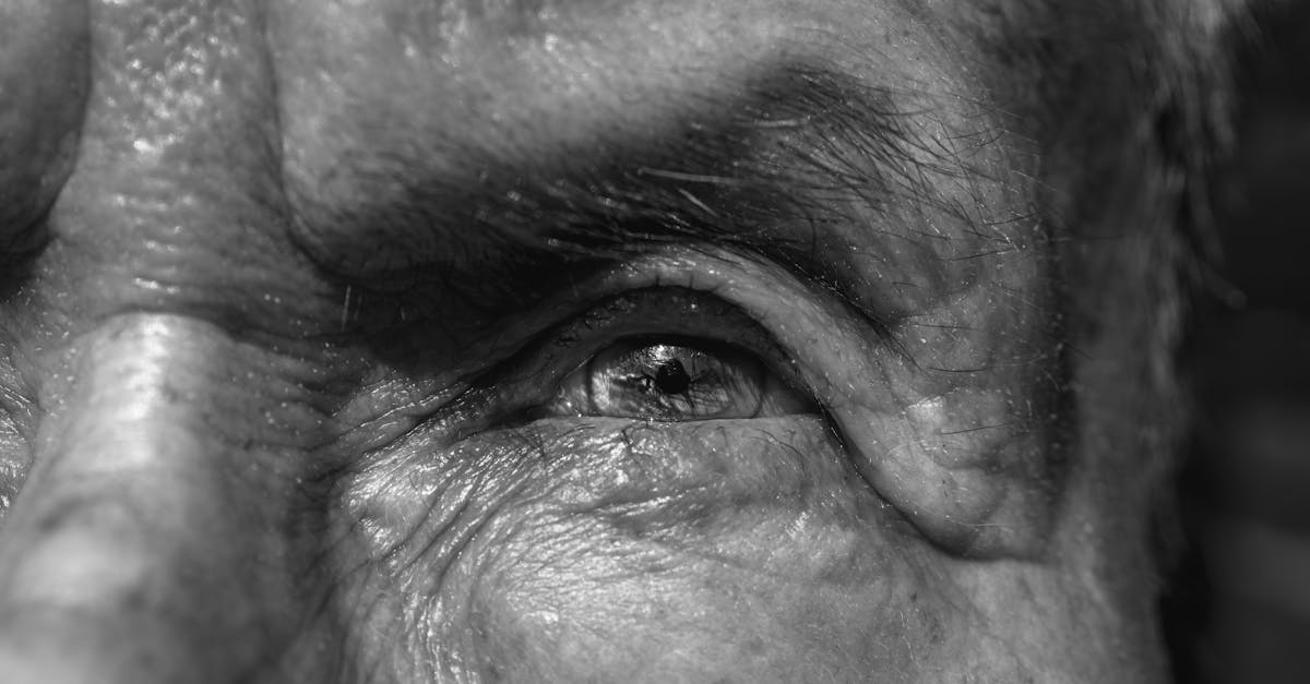 Your Eyes Age Like the Rest of You